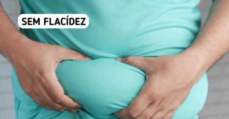 Emagrecer Sem Flacidez: Guia Completo para Perder Peso com Saúde